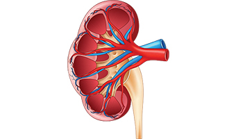 multinational-study-reveals-reduction-in-kidney-disease-thumb